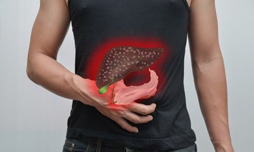 Gallbladder Cancer